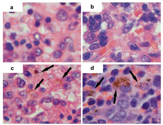 The prolongation of the lifespan of rats by repeated oral administration of [60] fullerene